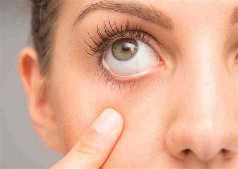Dry Eyes Symptoms Causes And Treatment Burjeel Hospital