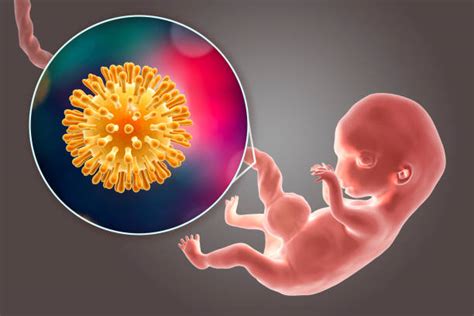 El citomegalovirus (cmv) es un virus que se encuentra en todo el mundo. El citomegalovirus y la sordera — CEPAL