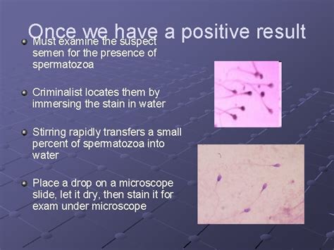 Forensic Characterization Of Semen Testing For Seminal Stains