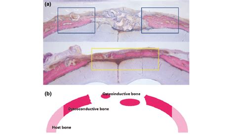 Representative Histological Sections A Of Osteoconductive Bone Blue