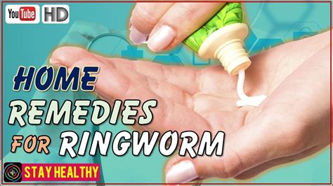 Ring Ringworm Treatment At Home Remedies