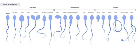 Sperm Morphology Defects Fertility Answers