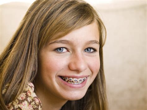 Braces Options For Teens Smile Town Burnaby Childrens Dentist