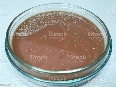Chocolate Agar Medium Growth Of Streptococcus Pneumoniae Staphylococcus