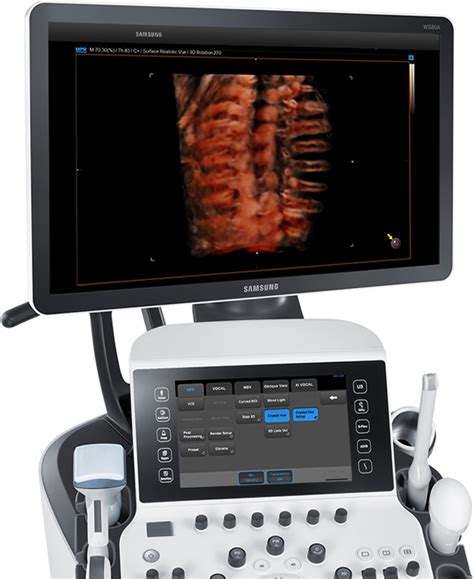 Ultrasound System Ws80a With Elite Samsung Healthcare Global
