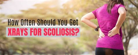 Ombre looks 3 to 6 months. How Often Should You get X-Rays for Scoliosis?