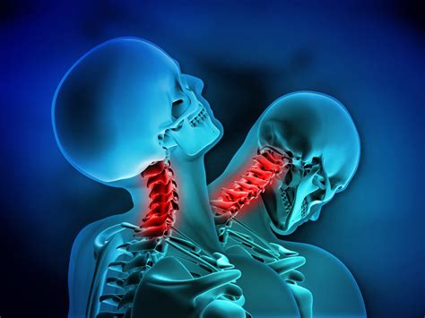 Pain In The Neck Common Neck Injuries Explained Norman Geisler