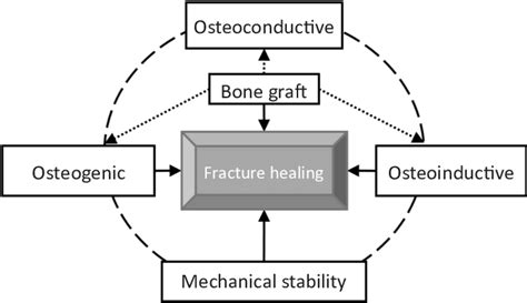 Role Of Bone Grafting In Fracture Healing Bone Grafts Are
