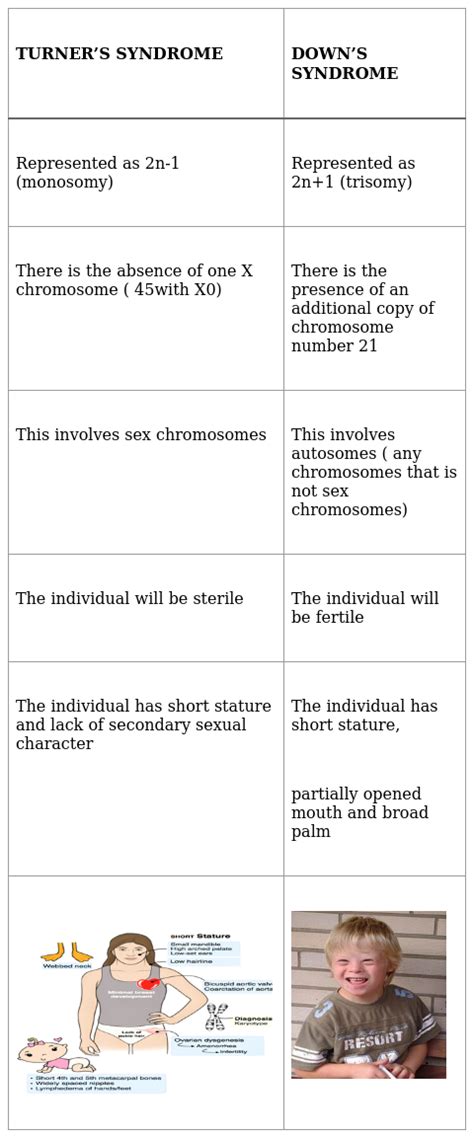 Differentiate Between Turners Syndrome And Downs Syndrome