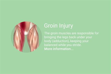 Groin Injury Alternative Muscular Therapy Medical Clinical Injury