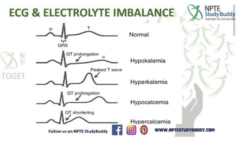 ECG And Electrolytes Imbalance Nursing Mnemonics Medical Coding Electrolytes Imbalance