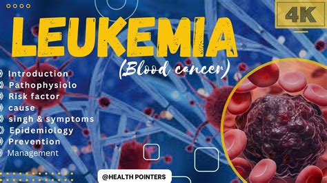 Understanding Leukemia Causes Symptoms And Treatment Health