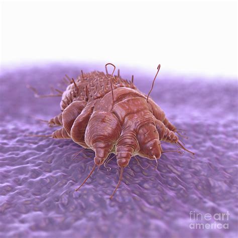Scabies Mite Photograph By Science Picture Co Pixels