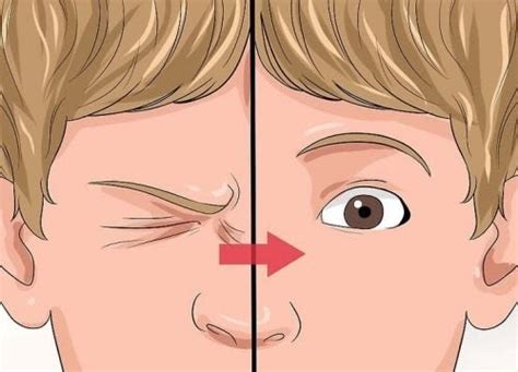 Vive Sana Consejos Para Tratar El Tic Nervioso En El Ojo
