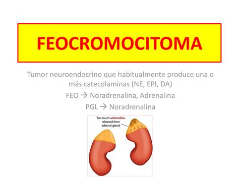 Feocromocitoma Y Paraganglioma Docsity