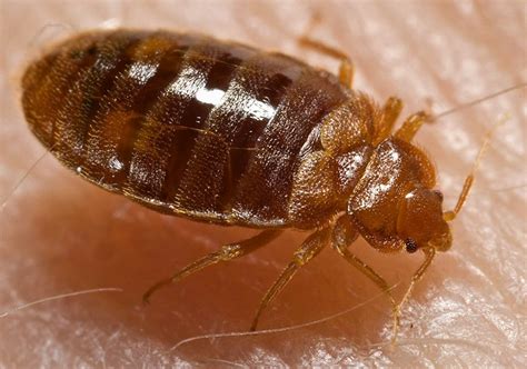 Bed Bugs Vs Scabies Whats The Difference Ess Universal