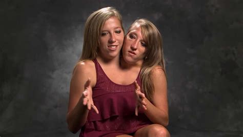 Conjoined Twins Abby And Brittany Singaporelasopa
