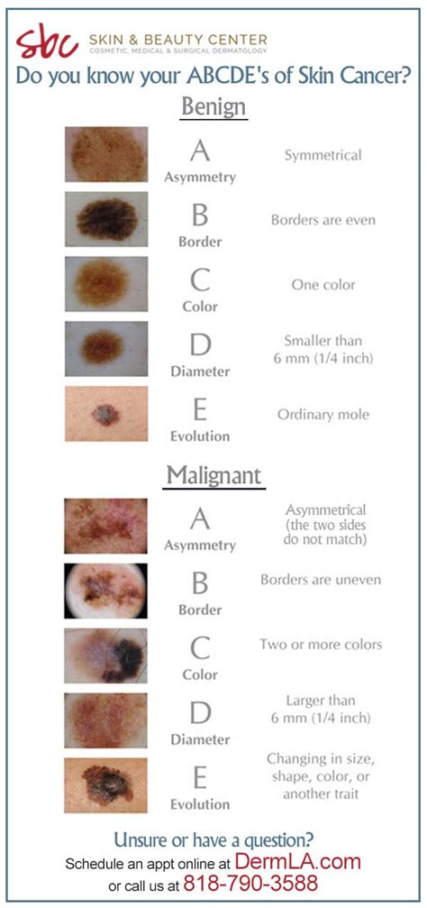 Dog Skin Cancer Chart