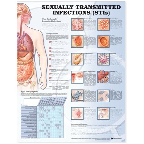 sexually transmitted infections anatomical chart — medshop new zealand