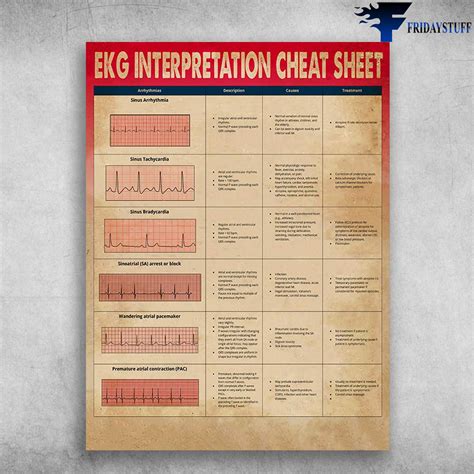 Ekg Interpretation Cheat Sheet Heart Arrhythmias Sinus Arrhythmia Sinus Tachycardia Sinus