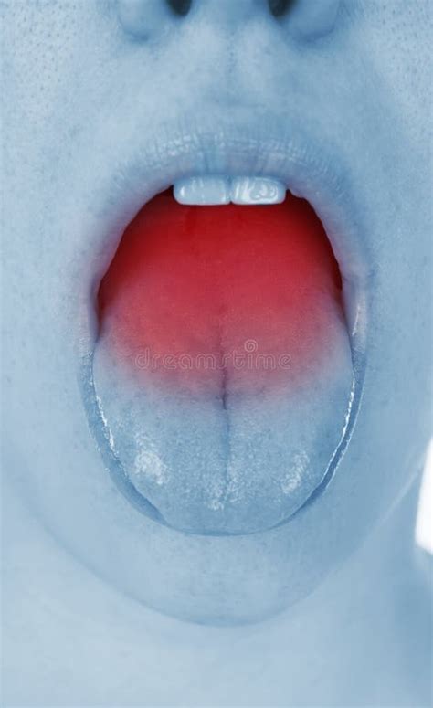Sore Throat Shown Red Keep Handed Stock Photo Image Of Adults