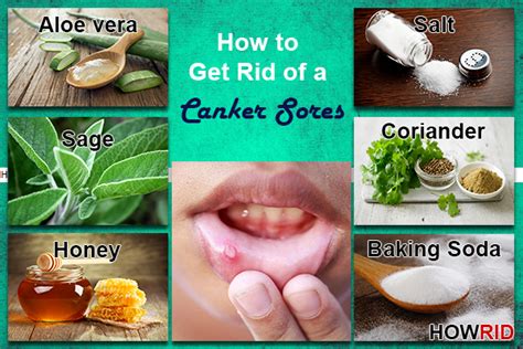 How To Get Rid Of A Canker Sore Overnight And Fast