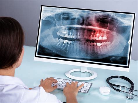 Why Do Dentists Take Dental X Rays