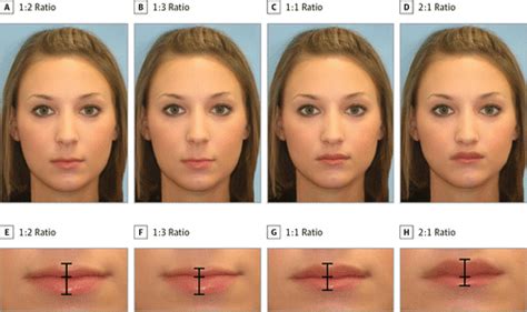 a quantitative approach to determining the ideal female lip aesthetic and its effect on facial