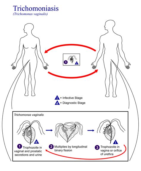 Trichomonas Vaginalis Stepwards