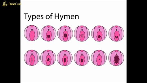 Hymen For Womens Health And More Youtube