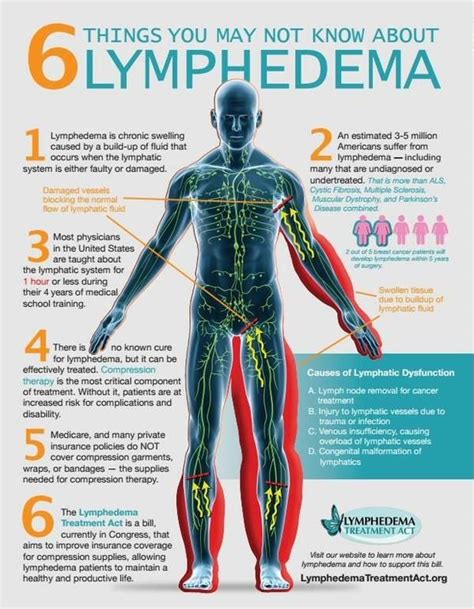 Lymphedema Manual Lymph Drainage Neck