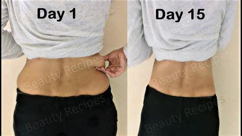 Lose Back Fat In 2 Weeks Easy Exercise Workout To Reduce Back Fat