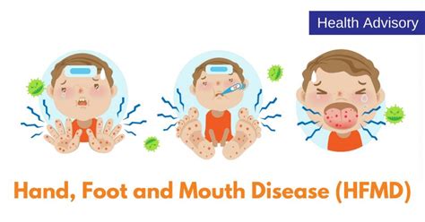 Things You Should Know About Hand Foot And Mouth Disease