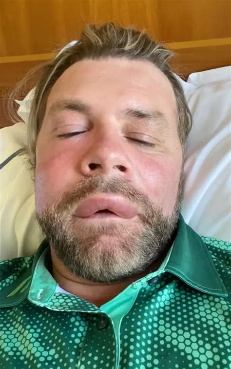 Westlifes Brian Mcfadden Rushes To Hospital After Being Stung By Bee Heart