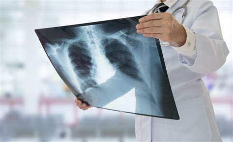 Our X Ray And Fluoroscopy Services In Santa Monica And Beverly Hills Lsg