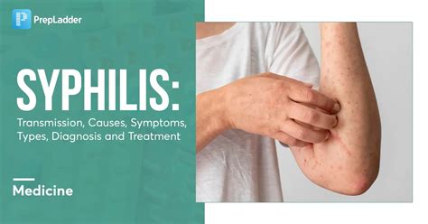 Syphilis Transmission Causes Symptoms Types Diagnosis And Treatment