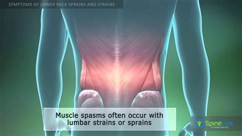 There are anterior muscles diagrams and posterior muscles diagrams. Lower Back Muscle Diag ~ Causes, Symptoms, and Treatment of a Bulging Disc Lower Back Muscle ...