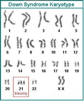 Down Syndrome Karyotype Colorful