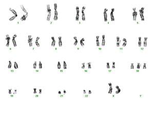 Cromossomos cariótipos e síndromes cromossômicas Biologia Enem