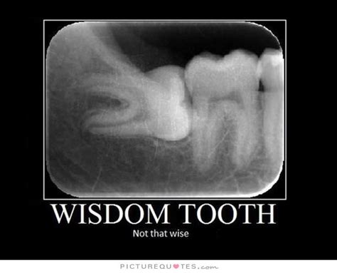 Wisdom Tooth Not That Wise Picture Quotes With Images Wisdom