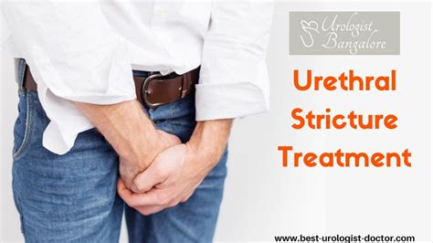 Urethral Stricture Treatment Best Treatment For Urethral Stricture