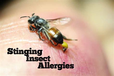 The Danger Behind Stinging Insect Allergy Arthritis Autoimmune And Allergy