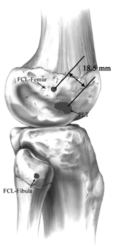 Ligaments Of The Knee Recon Orthobullets