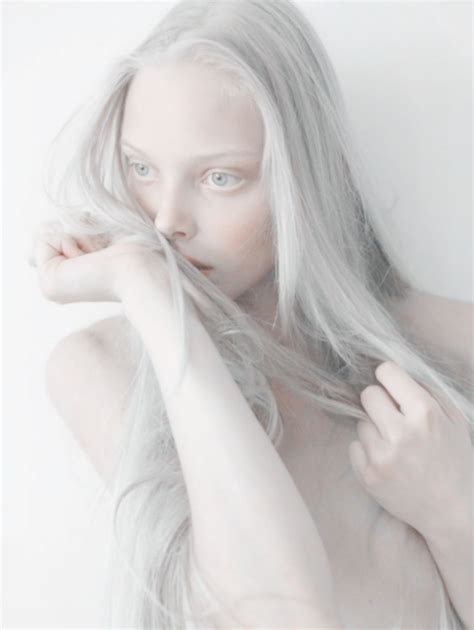 Pin By Beka On Art Simplicity Life Albino Model Albinism Pale Skin
