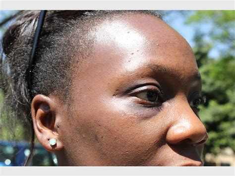 Woman Brutally Assaulted By Security Guard Rosebank Killarney Gazette