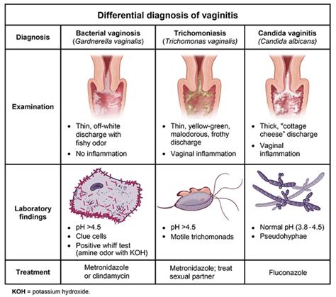 Enhancement Pills Male Enhancement Np School Bacterial Vaginosis Vaginal Health Obgyn