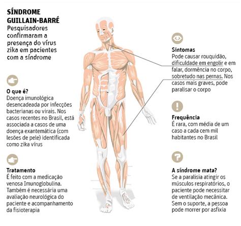 Afección rara por la que el sistema inmunitario del cuerpo ataca los nervios fuera del encéfalo y la médula espinal. SINDROME DE GUILLAIN BARRE PDF