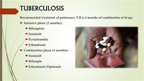 isoniazid rifampicin pyrazinamide and ethambutol ppt