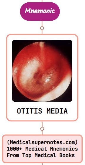 Acute Otitis Media Epidemiology And Etiology Mnemonic Rmedicomnemonics