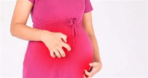 Cholestasis Of Pregnancy Why You Cant Ditch The Itch